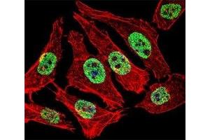 Fluorescent confocal image of A549 cell stained with FOXA2 antibody at 1:25.