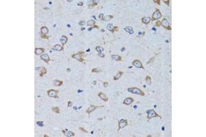 Immunohistochemistry of paraffin-embedded rat brain using RARS antibody (ABIN5973728) at dilution of 1/100 (40x lens). (RARS anticorps)