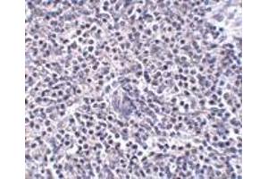 Immunohistochemistry (IHC) image for anti-ADP-Ribosylation Factor-Like 15 (ARL15) (Middle Region) antibody (ABIN1030866) (ARL15 anticorps  (Middle Region))