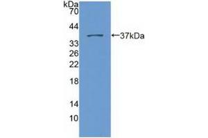 Detection of Recombinant Nesp2, Human using Polyclonal Antibody to Nesprin 2 (Nesp2) (SYNE2 anticorps  (AA 6-296))