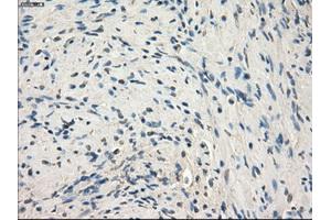 Immunohistochemical staining of paraffin-embedded endometrium tissue using anti-MAP2K1 mouse monoclonal antibody. (MEK1 anticorps)