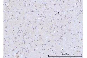 IHC analysis of RBM22 using anti-RBM22 antibody (ABIN7600268). (RBM22 anticorps  (AA 17-406))