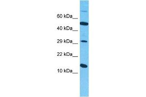 Host:  Rabbit  Target Name:  SYUB  Sample Type:  786-0 Whole Cell lysates  Antibody Dilution:  1ug/ml (beta Synuclein anticorps  (C-Term))
