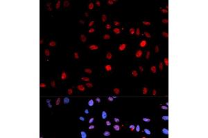 Immunofluorescence analysis of U2OS cells using Phospho-p53(S15) Polyclonal Antibody (p53 anticorps  (pSer15))
