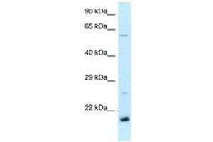 Image no. 1 for anti-TATA-Binding Protein-Associated Phosphoprotein (DR1) (AA 63-112) antibody (ABIN6747863) (DR1 anticorps  (AA 63-112))
