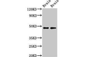 Western Blot Positive WB detected in: Rat brain tissue, Mouse brain tissue All lanes: CRHR2 antibody at 3 μg/mL Secondary Goat polyclonal to rabbit IgG at 1/50000 dilution Predicted band size: 48, 51, 47, 45, 43 kDa Observed band size: 34 kDa