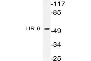 Western blot (WB) analysis of LIR-6 antibody in extracts from MCF-7 cells. (LILRA1 anticorps)