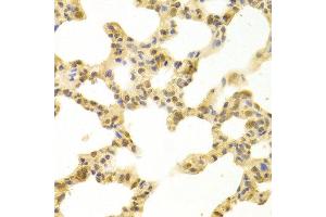 Immunohistochemistry of paraffin-embedded rat lung using POLB antibody at dilution of 1:100 (x400 lens). (POLB anticorps)