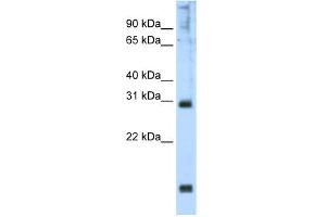 WB Suggested Anti-Hoxb1 Antibody Titration:  2.