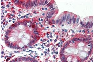 Human Colon: Formalin-Fixed, Paraffin-Embedded (FFPE) (ALDH1A1 anticorps  (AA 1-502))