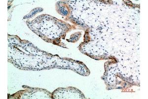 Immunohistochemical analysis of paraffin-embedded human-placenta, antibody was diluted at 1:200 (EDNRB anticorps  (AA 31-80))