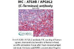 Image no. 2 for anti-Autophagy Related 9B (ATG9B) (C-Term) antibody (ABIN1732024) (ATG9B anticorps  (C-Term))