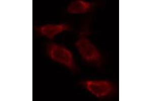 ABIN6273994 staining Hela by IF/ICC. (TUBB1 anticorps)