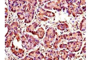 Immunohistochemistry of paraffin-embedded human pancreatic tissue using ABIN7175846 at dilution of 1:100 (WISP1 anticorps  (AA 130-251))