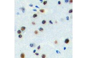 Immunohistochemical analysis of ZNF785 staining in human brain formalin fixed paraffin embedded tissue section. (ZNF785 anticorps)