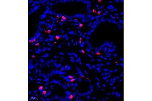 Immunofluorescent analysis of paraffin embedded rat uterus using S100A9 (ABIN7075497) at dilution of 1: 900