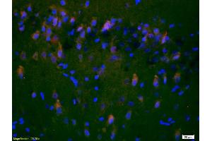 Formalin-fixed and paraffin-embedded rat brain labeled with Anti-NR2A/NMDAR2A Polyclonal Antibody, Unconjugated (ABIN747353) 1:200, overnight at 4°C, The secondary antibody was Goat Anti-Rabbit IgG, Cy3 conjugated used at 1:200 dilution for 40 minutes at 37°C. (NMDAR2A anticorps  (AA 851-950))