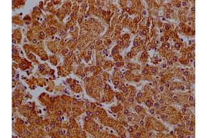 Immunohistochemistry of paraffin-embedded human liver tissue using ABIN7147805 at dilution of 1:100
