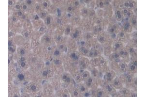 Detection of IL12A in Mouse Liver Tissue using Polyclonal Antibody to Interleukin 12A (IL12A)