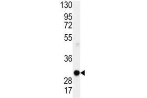 Western blot analysis of Cyclin D1 antibody and mouse lung lysate.