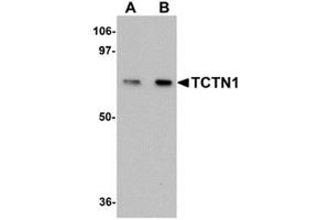 Western blot analysis of TCTN1 in mouse kidney tissue lysate with TCTN1 antibody at (A) 1 and (B) 2 μg/ml.