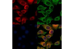 ABIN6264567 and ABIN6276965 staining Hela cells by IF/ICC. (RAB27A anticorps  (C-Term))