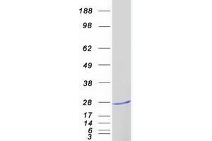 Validation with Western Blot
