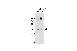 All lanes : Anti-RQCD1 Antibody (Center) at 1:500 dilution Lane 1: HL-60 whole cell lysate Lane 2: MOLT-4 whole cell lysate Lysates/proteins at 20 μg per lane. (RQCD1 anticorps  (AA 106-134))