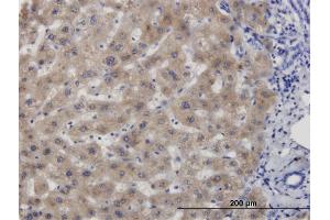 Immunoperoxidase of monoclonal antibody to CBS on formalin-fixed paraffin-embedded human liver. (CBS anticorps  (AA 1-100))