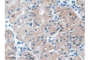 Detection of PLCB1 in Human Stomach Tissue using Polyclonal Antibody to Phospholipase C Beta 1 (PLCB1)