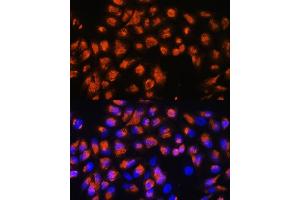 Immunofluorescence analysis of HeLa cells using AGRN Rabbit pAb (ABIN7265516) at dilution of 1:100.
