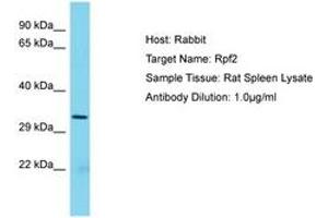 Image no. 1 for anti-Ribosome Production Factor 2 Homolog (RPF2) (AA 77-126) antibody (ABIN6750445) (RPF2 anticorps  (AA 77-126))