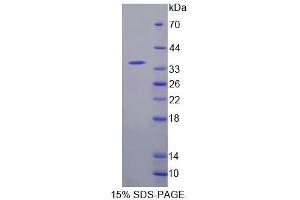 SDS-PAGE analysis of Mouse CDK20 Protein. (CCRK Protéine)
