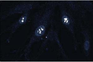 Immunofluorescence staining of human fibroblasts. (CDK4 anticorps  (AA 1-303))