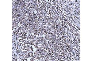 IHC analysis of GLUD1/2 using anti-GLUD1/2 antibody (ABIN7602000). (GLUD1 / GLUD2 (AA 54-553) anticorps)