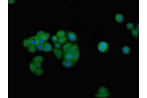 Immunofluorescence staining of PC-3 cells with ABIN7156602 at 1:100, counter-stained with DAPI.