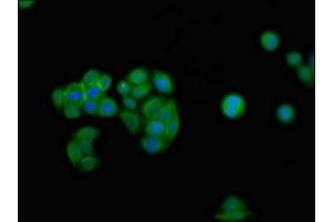Immunofluorescence staining of PC-3 cells with ABIN7156602 at 1:100, counter-stained with DAPI. (IFNGR2 anticorps  (AA 28-205))
