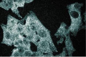 Immunofluorescence staining of HeLa cells.