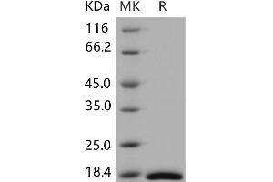 Western Blotting (WB) image for Cellular Retinoic Acid Binding Protein 2 (CRABP2) protein (His tag) (ABIN7320242) (CRABP2 Protein (His tag))