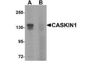 Western blot analysis of CASKIN1 in HeLa cell lysate with CASKIN1 Antibody  at 1 μg/ml in (A) the absence and (B) the presence of blocking peptide. (CASKIN1 anticorps  (Middle Region))