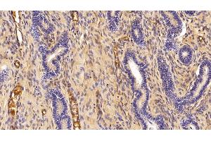 Detection of Hpt in Porcine Uterus Tissue using Polyclonal Antibody to Haptoglobin (Hpt)