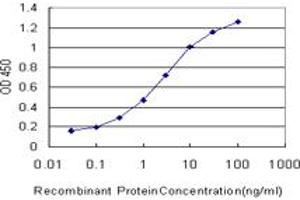 Detection limit for recombinant GST tagged ATRX is approximately 0. (ATRX anticorps  (AA 2311-2410))