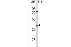 SIRPB2 Antibody (C-term) (ABIN1536893 and ABIN2838213) western blot analysis in ZR-75-1 cell line lysates (35 μg/lane). (SIRPb2 anticorps  (C-Term))