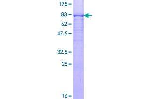Image no. 1 for Protein Phosphatase 3, Catalytic Subunit, beta Isozyme (PPP3CB) (AA 1-525) protein (GST tag) (ABIN1316068)