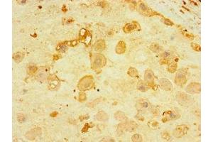 Immunohistochemistry of paraffin-embedded human placenta tissue using ABIN7165176 at dilution of 1:100 (CNPY4 anticorps  (AA 22-248))