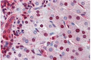 Human Liver (formalin-fixed, paraffin-embedded) stained with NR0B2 antibody ABIN462246 followed by biotinylated goat anti-rabbit IgG secondary antibody ABIN481713, alkaline phosphatase-streptavidin and chromogen.