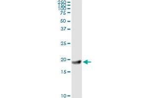 Immunoprecipitation of FTL transfected lysate using anti-FTL monoclonal antibody and Protein A Magnetic Bead , and immunoblotted with FTL MaxPab rabbit polyclonal antibody.