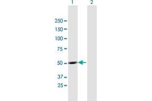 Western Blot analysis of UBQLNL expression in transfected 293T cell line by UBQLNL MaxPab polyclonal antibody. (UBQLNL anticorps  (AA 1-475))