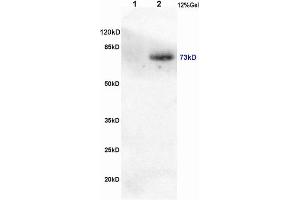 L1 rat brain, L2 human colon carcinoma lysates probed (ABIN746558) at 1:200 in 4 °C. (CRTC1 anticorps  (pSer151))