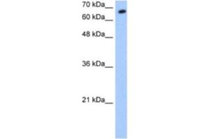 Western Blotting (WB) image for anti-Synovial Apoptosis Inhibitor 1, Synoviolin (SYVN1) antibody (ABIN2462687) (SYVN1 anticorps)